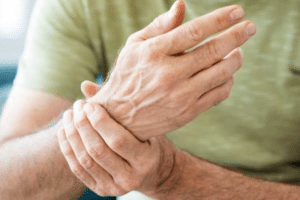 Arthritis in Wrist