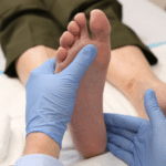 How to Remove Uric Acid Crystals from Toe Naturally