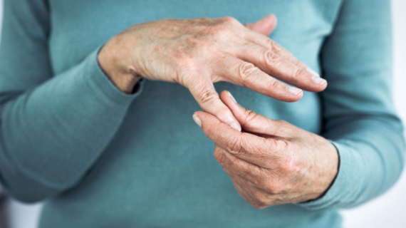 How to Cure Arthritis in Hand Without Therapy