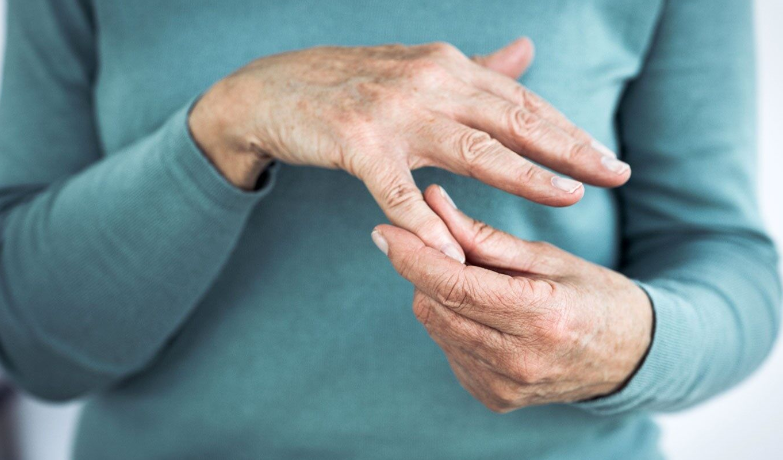 how to cure arthritis in hand