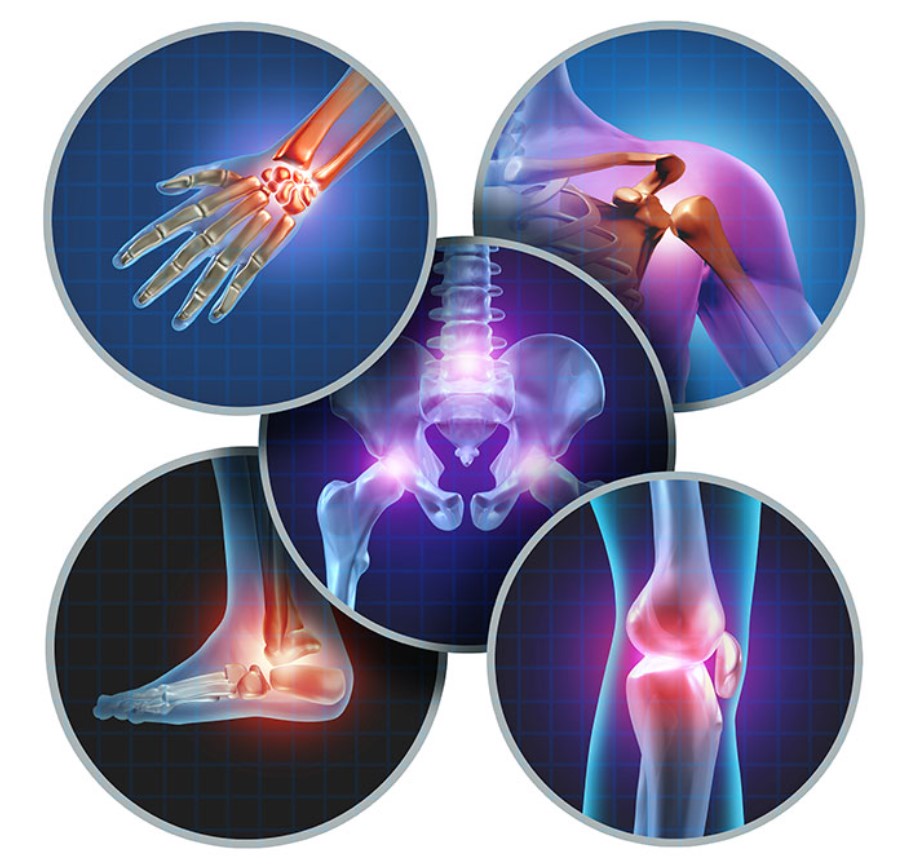Understanding Inflammation and Its Impact on Joint Health